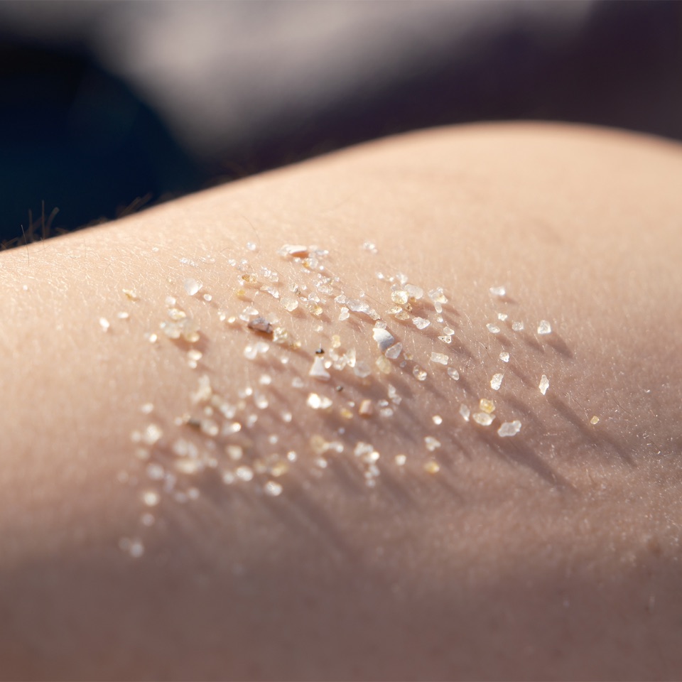Grains of sand on skin